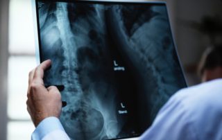 doctor looking at an x-ray of the back
