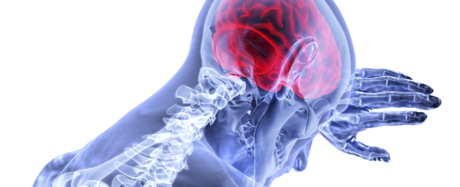 illustration of upper skeletal system showing a bright red brain
