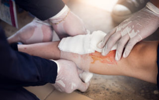 two people wearing medical gloves putting gauze on a bloody shin