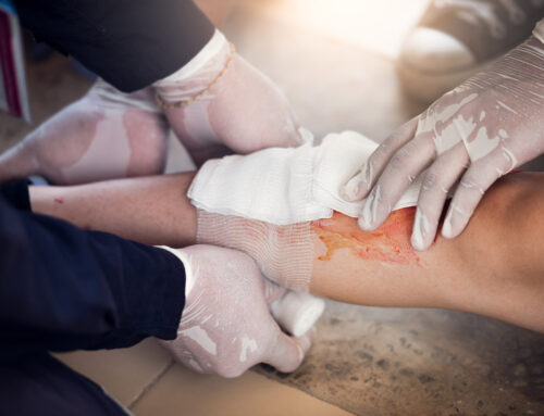 Compensation Corner: Understanding the Most Common Workers’ Comp Injuries